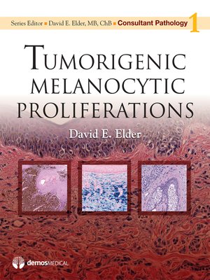 cover image of Tumorigenic Melanocytic Proliferations